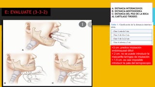 Distancia
interdental
<3 cm. predice intubación
endotraqueal dificil
< 2 cm. no se puede introducir la
mascarilla laríngea de intubación
< 1,5 cm. es casi imposible
introducir la pala del laringoscopio
E: EVALUATE (3-3-2)
A: DISTANCIA INTERINCISIVOS
B: DISTANCIA MENTOHIOIDEA
C: DISTANCIA DEL PISO DE LA BOCA
AL CARTÍLAGO TIROIDES
 