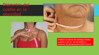 Diámetro del
cuello en la
obesidad
medida a la altura del cartílago tiroides
superior a 42 cm. se considera un
predictor de laringoscopia difícil o de ID
 