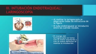 III. INTUBACIÓN ENDOTRAQUEAL:
LARINGOSCOPÍA
• Al realizar la laringoscopía se
observarán todas las estructuras de
la figura.
• El tubo endotraqueal se introducirá
entre las cuerdas vocales.
 