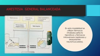 ANESTESIA GENERAL BALANCEADA
En esta modalidad se
utilizan fármacos
inhalados (efecto
hipnótico) y fármacos
intravenosos (opiáceos y
bloqueantes
neuromusculares).
 