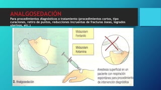 ANALGOSEDACIÓN
Para procedimientos diagnósticos o tratamiento (procedimientos cortos, tipo
curaciones, retiro de puntos, reducciones incruentas de fracturas óseas, legrados
uterinos, etc.)
 