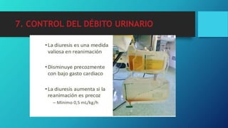 7. CONTROL DEL DÉBITO URINARIO
 