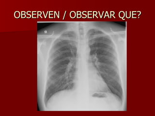 OBSERVEN / OBSERVAR QUE? 