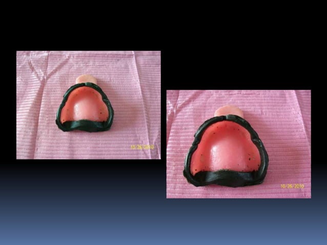 Clase rectif. bordes 14 15 | PPTX