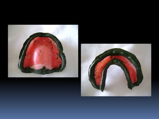 Clase rectif. bordes 14 15 | PPTX