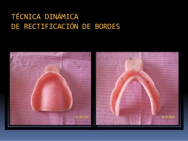 Clase rectif. bordes 14 15