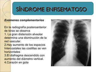 Exámenes complementarios
En la radiografía posteroanterior
de tórax se observa
1. La gran distensión alveolar
determina una disminución de la
red vascular.
2.Hay aumento de los espacios
Intercostales las costillas se ven
horizontales
3.El diafragma descendido con
aumento del diámetro vertical.
4.Corazón en gota
SÍNDROME ENFISEMATOSOSÍNDROME ENFISEMATOSO
 