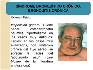 SÍNDROME BRONQUÍTICO CRÓNICO.
BRONQUITIS CRÓNICA
Examen físico:
Inspección general. Puede
haber osteoartropatía
néumica hipertrofiante en
los casos muy antiguos.
Facies: en los casos muy
avanzados, con limitación
crónica del flujo aéreo, se
aprecia la facies del
“abotagado azul” (blue
bloater de la literatura
anglosajona)
 