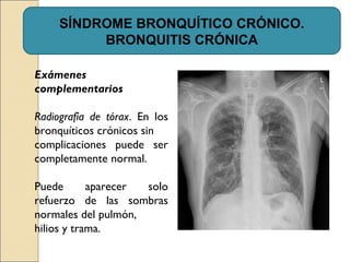 Exámenes
complementarios
Radiografía de tórax. En los
bronquíticos crónicos sin
complicaciones puede ser
completamente normal.
Puede aparecer solo
refuerzo de las sombras
normales del pulmón,
hilios y trama.
SÍNDROME BRONQUÍTICO CRÓNICO.
BRONQUITIS CRÓNICA
 