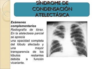 SÍNDROME DESÍNDROME DE
CONDENSACIÓNCONDENSACIÓN
ATELECTÁSICAATELECTÁSICA
Exámenes
complementarios
Radiografía de tórax.
En la atelectasia parcial
se aprecia
una opacidad completa
del lóbulo afectado y
una mayor
transparencia de los
lóbulos restantes
debida a función
vicariante.
 