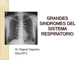 GGRANDESRANDES
SINDROMES DELSINDROMES DEL
SISTEMASISTEMA
RESPIRATORIORESPIRATORIO
Dr. Ragnar Vegueria
May-2013
 