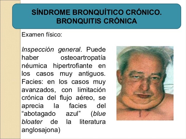 ABOTAGADO AZUL EBOOK DOWNLOAD ABOTAGADO AZUL EBOOK DOWNLOAD