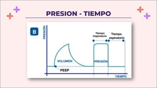 PRESION - TIEMPO
 