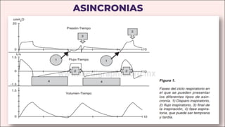 ASINCRONIAS
 
