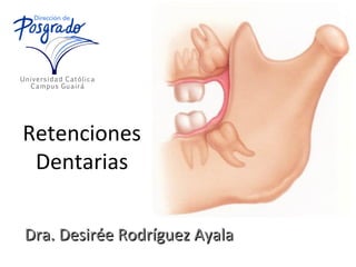 Retenciones
Dentarias
Dra. Desirée Rodríguez AyalaDra. Desirée Rodríguez Ayala
 