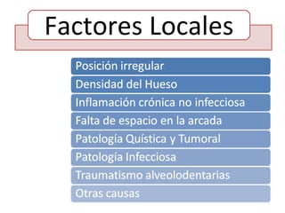 Factores Locales
 