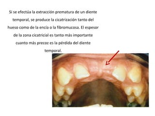 Si se efectúa la extracción prematura de un diente
temporal, se produce la cicatrización tanto del
hueso como de la encía o la fibromucosa. El espesor
de la zona cicatricial es tanto más importante
cuanto más precoz es la pérdida del diente
temporal.
 