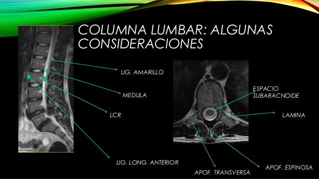 El dolor en el campo del cuello de la parte izquierda y la clavícula