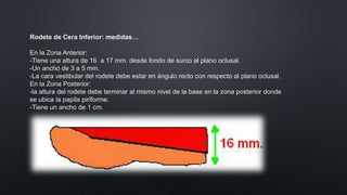 Rodetes de oclusion | PPTX