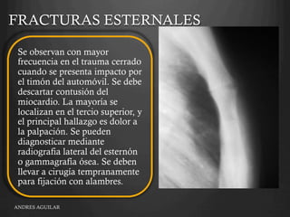 Trauma Toracoabdominal | PDF