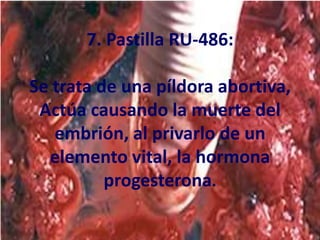 7. Pastilla RU-486: Se trata de una píldora abortiva, Actúa causando la muerte del embrión, al privarlo de un elemento vital, la hormona progesterona. 