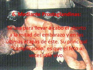 6. Mediante Prostaglandinas:Se usa para llevar a cabo el aborto a la mitad del embarazo y en las últimas etapas de éste. Su principal "complicación" es que el feto a veces sale vivo. 