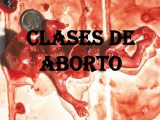 CLASES DE  ABORTO 