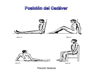 Posición Sedente
 