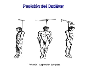 Posición suspensión completa
 