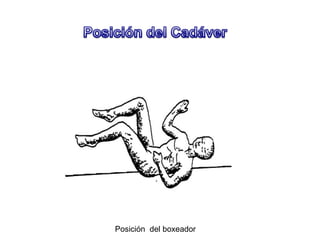 Posición del boxeador
 