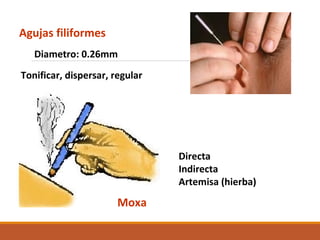 Agujas filiformes
Moxa
Diametro: 0.26mm
Tonificar, dispersar, regular
Directa
Indirecta
Artemisa (hierba)
 