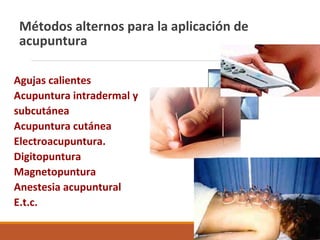 Métodos alternos para la aplicación de
acupuntura
Agujas calientes
Acupuntura intradermal y
subcutánea
Acupuntura cutánea
Electroacupuntura.
Digitopuntura
Magnetopuntura
Anestesia acupuntural
E.t.c.
 