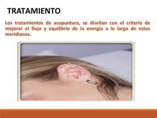 TRATAMIENTO
Los tratamientos de acupuntura, se diseñan con el criterio de
mejorar el flujo y equilibrio de la energía a lo largo de estos
meridianos.
 