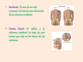 • Escoliosis: Es una de las más
comunes. Se trata de una desviación
de la columna vertebral.
• Hernia Discal: Se refiere a...