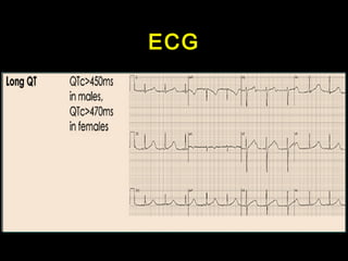 ECG 
 