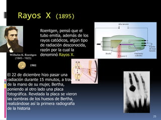 Rayos X                  (1895)

                       Roentgen, pensó que el
                       tubo emitía, además de los
                       rayos catódicos, algún tipo
                       de radiación desconocida,
                       razón por la cual la
 Wilhelm K. Roentgen   denominó Rayos X.
    (1845 - 1923)

               1901


El 22 de diciembre hizo pasar una
radiación durante 15 minutos, a través
de la mano de su mujer, Bertha,
poniendo al otro lado una placa
fotográfica. Revelada la placa se vieron
las sombras de los huesos de Bertha,
realizándose así la primera radiografía
de la historia
                                                     25
 