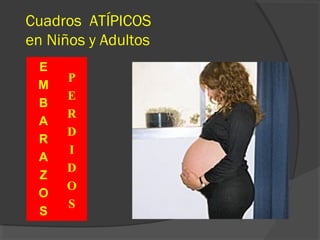 Cuadros ATÍPICOS
en Niños y Adultos
E
M
B
A
R
A
Z
O
S
P
E
R
D
I
D
O
S
 