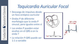 Taquicardia Auricular Focal
• Descarga de impulsos desde
un foco ectópico auricular
• Ondas P de diferente
morfología que la onda P
sinusal, pero iguales entre sí
• Las ondas P pueden estar
ocultas en el QRS o en la
onda T
• La relación P:QRS puede ser
1:1 o variable
 