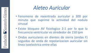Aleteo Auricular
• Fenomeno de reeentrada auricular a 300 por
minuto que suprime la actividad del nodulo
sinusal
• Existe bloqueo AV fisiologico 2:1 por lo que la
frecuencia ventricular es alrededor de 150 lpm
• Ondas auriculares en dientes de sierra (ondas F)
seguidas de onda de repolarizacion auricular sin
linea isoelectrica entre ellas
 