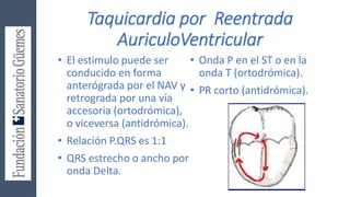 Taquicardia por Reentrada
AuriculoVentricular
• El estimulo puede ser
conducido en forma
anterógrada por el NAV y
retrograda por una vía
accesoria (ortodrómica),
o viceversa (antidrómica).
• Relación P.QRS es 1:1
• QRS estrecho o ancho por
onda Delta.
• Onda P en el ST o en la
onda T (ortodrómica).
• PR corto (antidrómica).
 