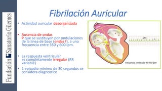 Fibrilación Auricular
• Actividad auricular desorganizada
• Ausencia de ondas
P que se sustituyen por ondulaciones
de la línea de base (ondas f), a una
frecuencia entre 350 y 600 lpm.
• La respuesta ventricular
es completamente irregular (RR
variable)
• 1 episodio minimo de 30 segundos se
considera diagnostico
 