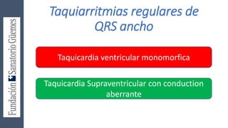 Taquiarritmias regulares de
QRS ancho
Taquicardia ventricular monomorfica
Taquicardia Supraventricular con conduction
aberrante
 