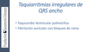 Taquiarritmias irregulares de
QRS ancho
• Taquicardia Ventricular polimórfica
• Fibrilación auricular con bloqueo de rama
 