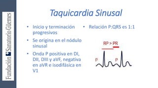 Taquicardia Sinusal
• Inicio y terminación
progresivos
• Se origina en el nódulo
sinusal
• Onda P positiva en DI,
DII, DIII y aVF, negativa
en aVR e isodifásica en
V1
• Relación P:QRS es 1:1
 