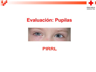 Evaluación: Pupilas
PIRRL
 