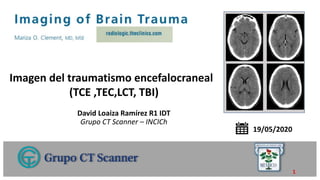 David Loaiza Ramírez R1 IDT
Grupo CT Scanner – INCICh
Imagen del traumatismo encefalocraneal
(TCE ,TEC,LCT, TBI)
Capítulo 39
19/05/2020
1
 