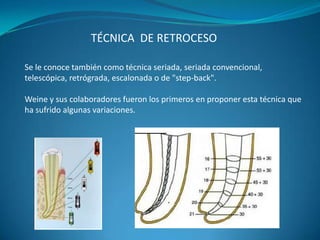 TÉCNICA DE RETROCESO

Se le conoce también como técnica seriada, seriada convencional,
telescópica, retrógrada, escalonada o de "step-back".

Weine y sus colaboradores fueron los primeros en proponer esta técnica que
ha sufrido algunas variaciones.
 