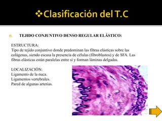 II. TEJIDO CONJUNTIVO DENSO REGULAR ELÁSTICO:
ESTRUCTURA:
Tipo de tejido conjuntivo donde predominan las fibras elásticas sobre las
colágenas, siendo escasa la presencia de células (fibroblastos) y de SFA. Las
fibras elásticas están paralelas entre sí y forman láminas delgadas.
LOCALIZACIÓN:
Ligamento de la nuca.
Ligamentos vertebrales.
Pared de algunas arterias.
 