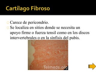 Carece de pericondrio.
Se localiza en sitios donde se necesita un
apoyo firme o fuerza tensil como en los discos
intervertebrales o en la sínfisis del pubis.
 
