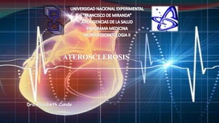 Dra.Elizabeth Conde
ATEROSCLEROSIS
 